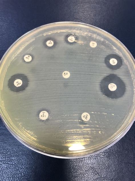 Examination Of Sputum Pseudomonas Aeruginosa Antibiotic Medizzy