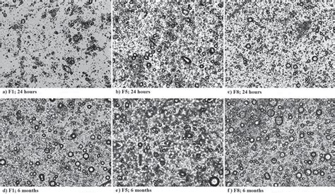 Figure From Design And In Vivo Evaluation Of Emulgel Formulations