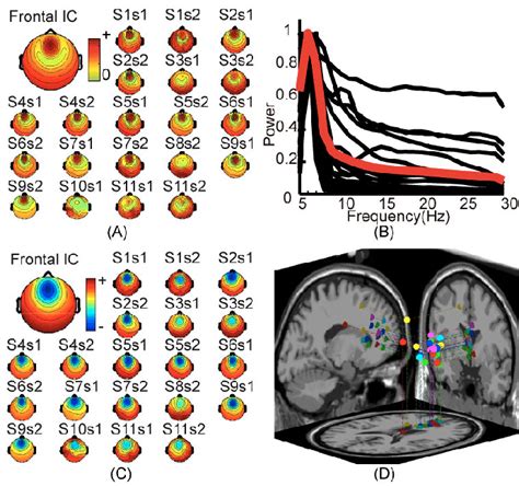 Frontal Ics Identified From Two Sessions In All Subjects A