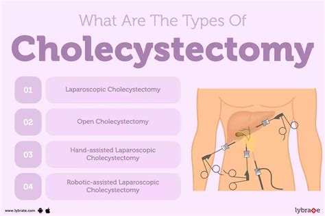 Open Cholecystectomy: Causes, Symptoms, Treatment and Cost