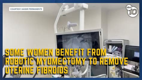 Fibroids Treated With Robotic Myomectomy YouTube