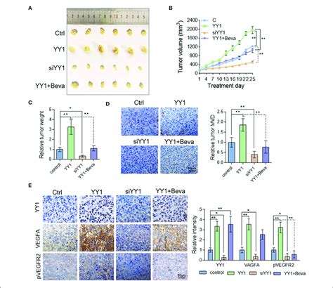 YY1 Enhanced Tumor Vascularization In HCC Xenograft Model By