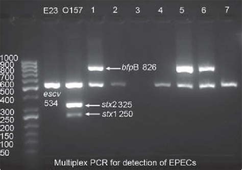 Figure 1 From Comparison Of Multiplex PCR With Serogrouping And PCR