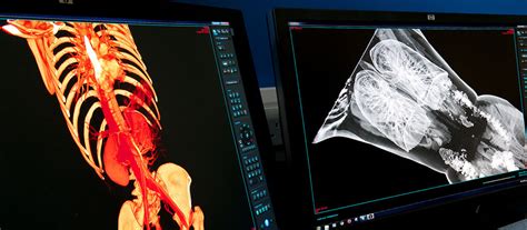 News Digital Autopsy The Future Of Post Mortem Examinations