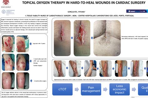 Topical Oxygen Therapy For Hard To Heal Wounds In Cardiac Surgery NATROX