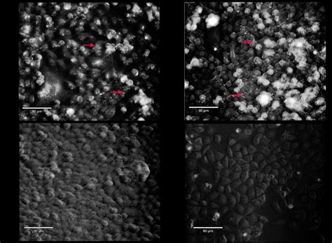 Live Cell Fluorescence Microscopy Of Synthetic Mycoplasmas Co Cultured