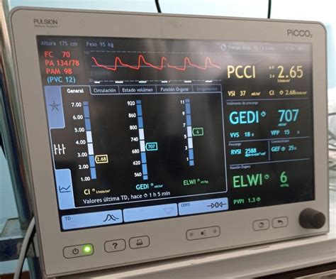 Manejo de Enfermería de la monitorización hemodinámica continua