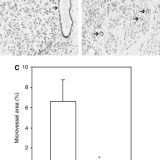 Tumour Vasculature In Solid MCF 7 Tumours In Nude Mice Mice Were