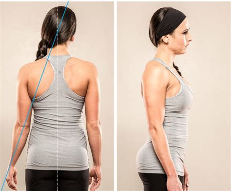 Posture Power How To Correct Your Bodys Alignment