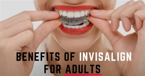 Benefits Of Invisalign Treatment For Adults In Irving Tx Irving