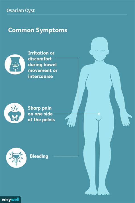 Ruptured Ovarian Cysts: Diagnosis, Treatment, and More