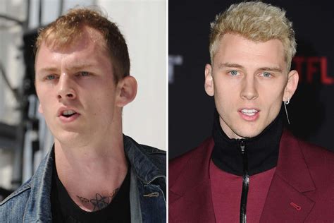 Did Machine Gun Kelly Get A Hair Transplant The Us Sun The Us Sun