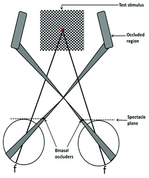 Representation Of The Binocular Visual Field With Binasal Occluders In