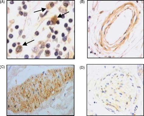 Immuno Histochemical Localization Of Hsp60 To The Adventitia Of Human