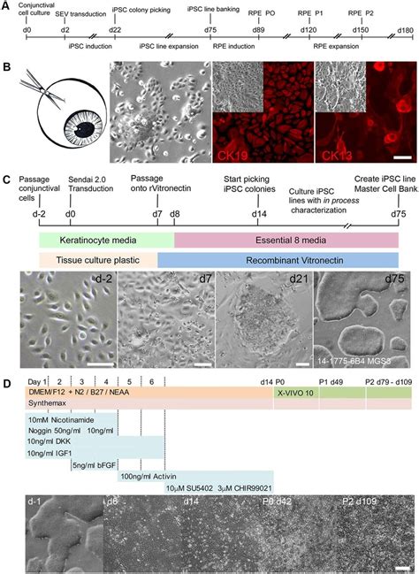 IPSC Reprogramming And Differentiation Of Conjunctival Cells Into RPE