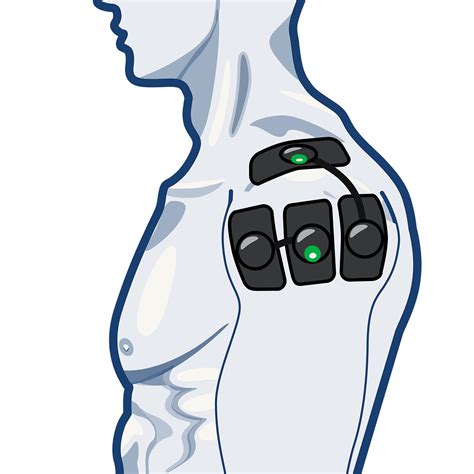 Electrode Placement For Muscle Stimulation Compex