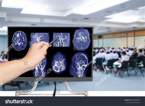 Mra Brain Magnetic Resonance Angiography Cerebral Stock Photo