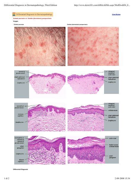 Differential Diagnosis In Dermatopathology Third Edition