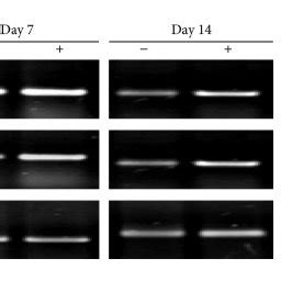 Proliferative Response Of Microtia Chondrocytes Treated With PRP During