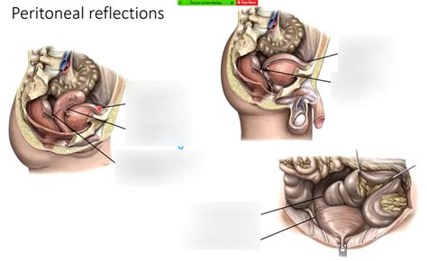 Peritoneal Reflections Diagram Quizlet