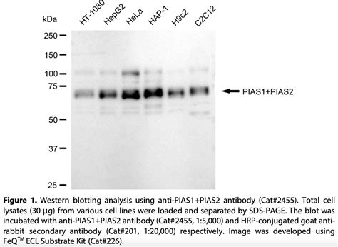 Anti PIAS1 PIAS2 Rabbit Monoclonal Ab 2455 GenuIN Biotech