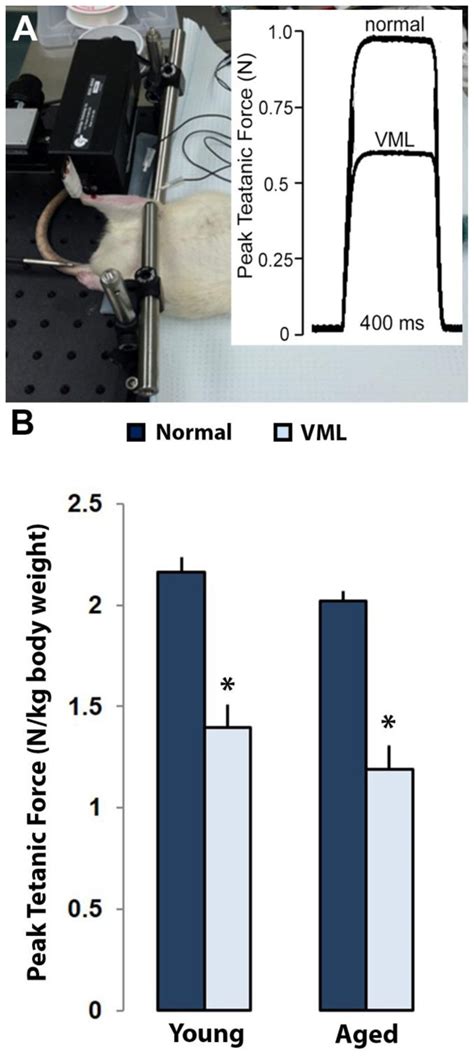 Peak Tetanic Force Measurements Of Young And Aged Rats Via