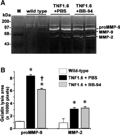 Western Blot Analysis Of Myocardial MMPs Sequential Western Blot