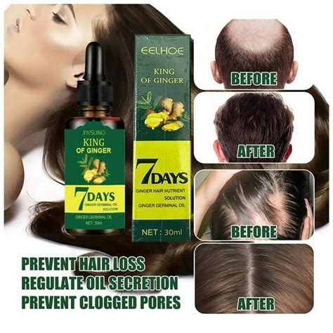 Regrow 7 Day Ginger Germinal Hair Growth Serum Hairdressing Oil Loss Treatment 30ml