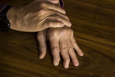 Arthritis Symptoms: 6 Misconceptions | Fort Worth Doctors