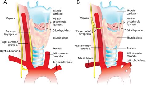 Recurrent Laryngeal Nerve