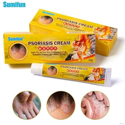 Original Sumifun Psoriasis Cream Bacteriostasis Eczema Dermatitis