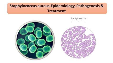 Staphylococcus Aureus Epidemiology Pathogenesis And Treatment