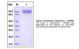 Cellexp Human Recombinant Osteoactivin Gpnmb From Hek Cells Vwr