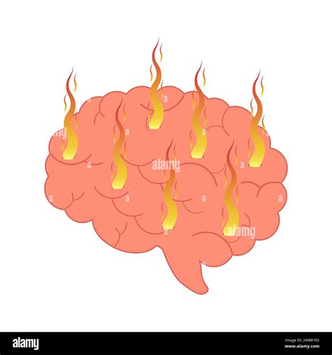 Burning Brain Human Brain In A Flame Of Fire Vector Illustration