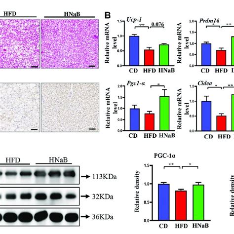 Effects of NaB on brown adipose tissue in DIO. (A) H&E staining, scale ...