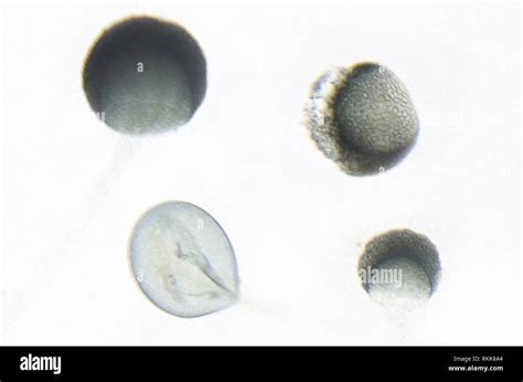 Rhizopus Stolonifer Microscope