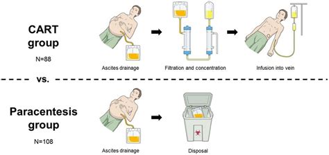 Paracentesis Drainage Color Best Drain Photos Primagemorg