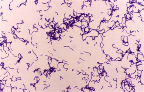 Fichas de aprendizaje EXAM BACTERIOLOGÍA 2DO PARCIAL ERYSIPELOTHRIX