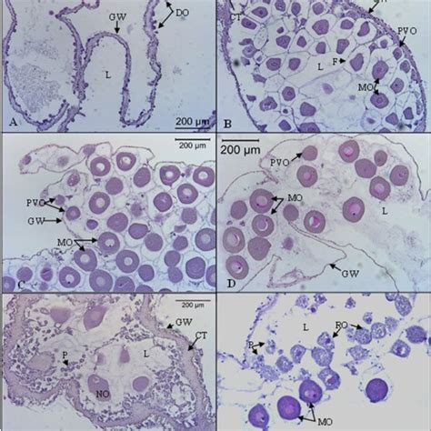 Microscopical Characteristics Of Gonad Development Stages Of The Download Scientific Diagram