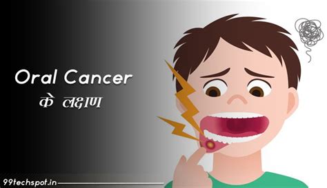 Oral Cancer Ke Lakshan In Hindi Archives Techspot In