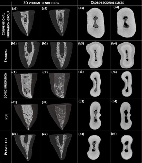 Representative 3d Reconstructions Of Micro Ct Scans 1 And 2 And Download Scientific Diagram