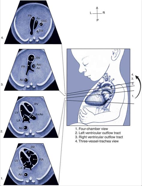 Fetal Heart Position Ultrasound