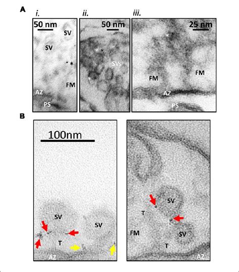 Immunogold Labeling Method A Standard Immunogold Labeling Method