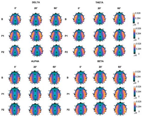 Cortical Dynamics Of EEG Relative Power Variation Across Conditions