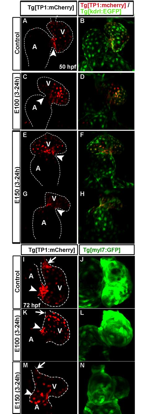 High Notch Activity Was Not Restricted At The Avc Endocardial Cells In