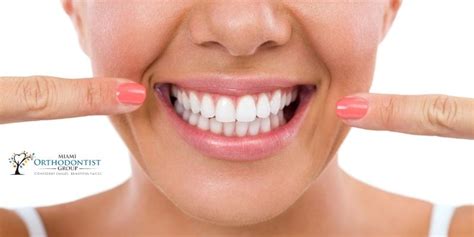 The Benefits Of A More Aligned Bite Miami Orthodontist Group