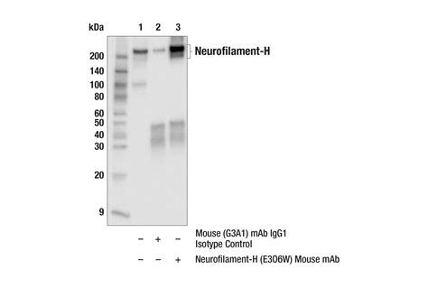 Neurofilament H E3o6w Mouse Mab Cell Signaling Technology