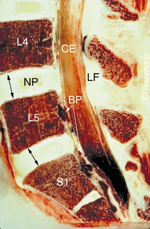 Dr Helmut Hiertz Neurochirurg Wirbelsäule