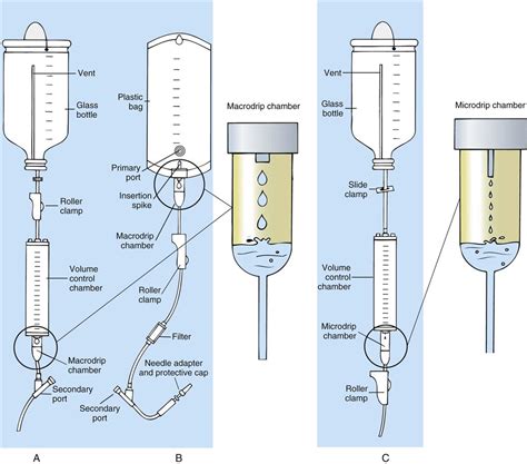 Iv Set Diagram