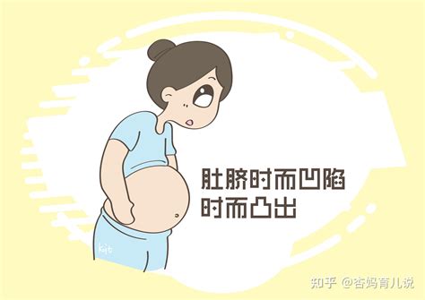 孕期肚脐的“凹凸”是几个意思？拥有前者，就偷着乐吧 知乎